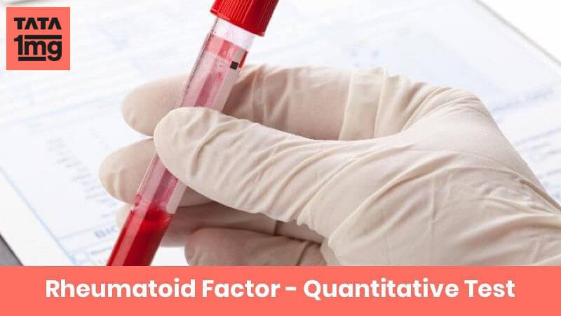 Rheumatoid Factor - Quantitative
